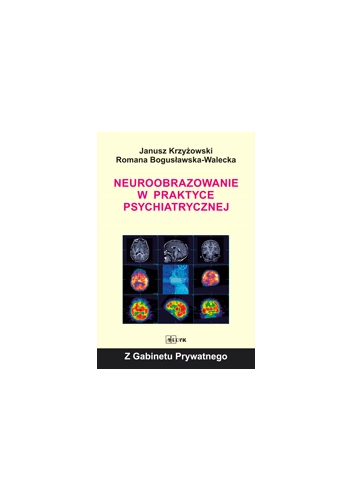 Neuroobrazowanie w praktyce psychiatrycznej